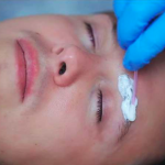 A cosmetic artist applying numbing cream before the Microblading procedure. 