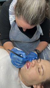 A lip neutraliser specialist carrying out the procedure on a client.