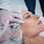 Woman with marked face receiving a Baby Botox injection.